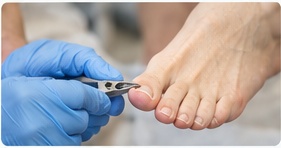 Nail cutting foot care photograph